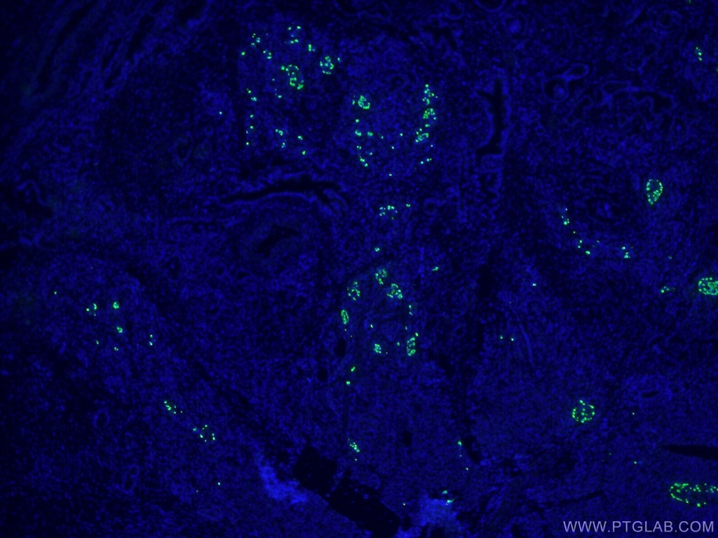 Glucagon Polyclonal antibody