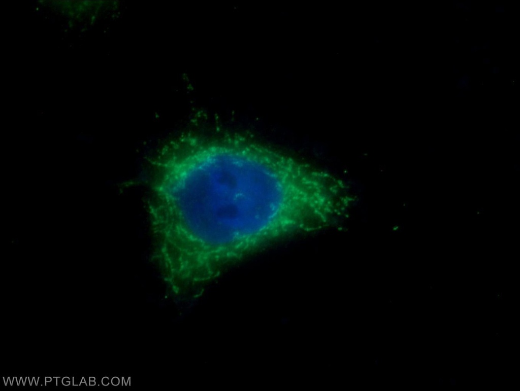 Elafin/Skalp Polyclonal antibody