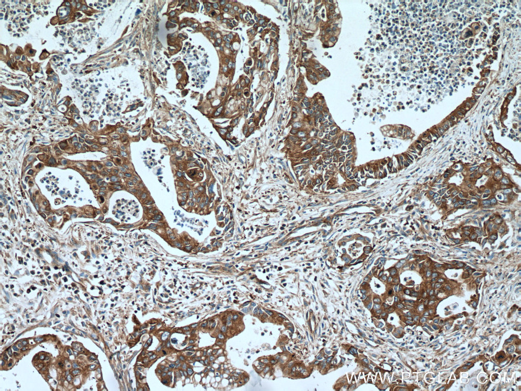 UBR4 Polyclonal antibody