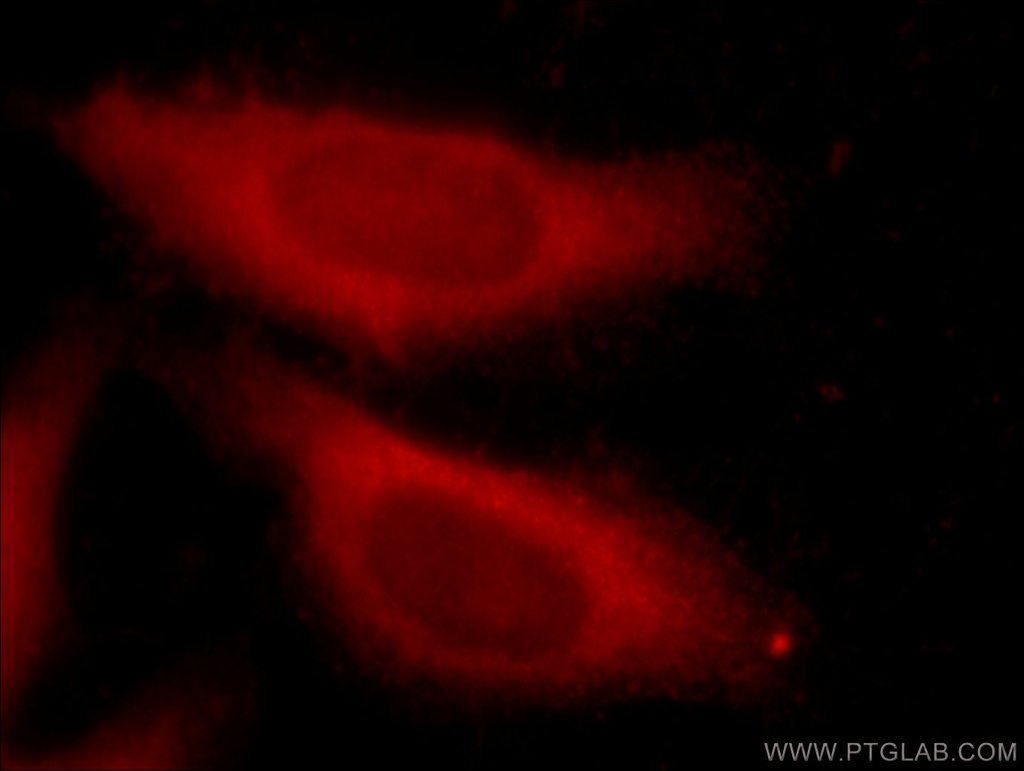 SDCCAG3 Polyclonal antibody