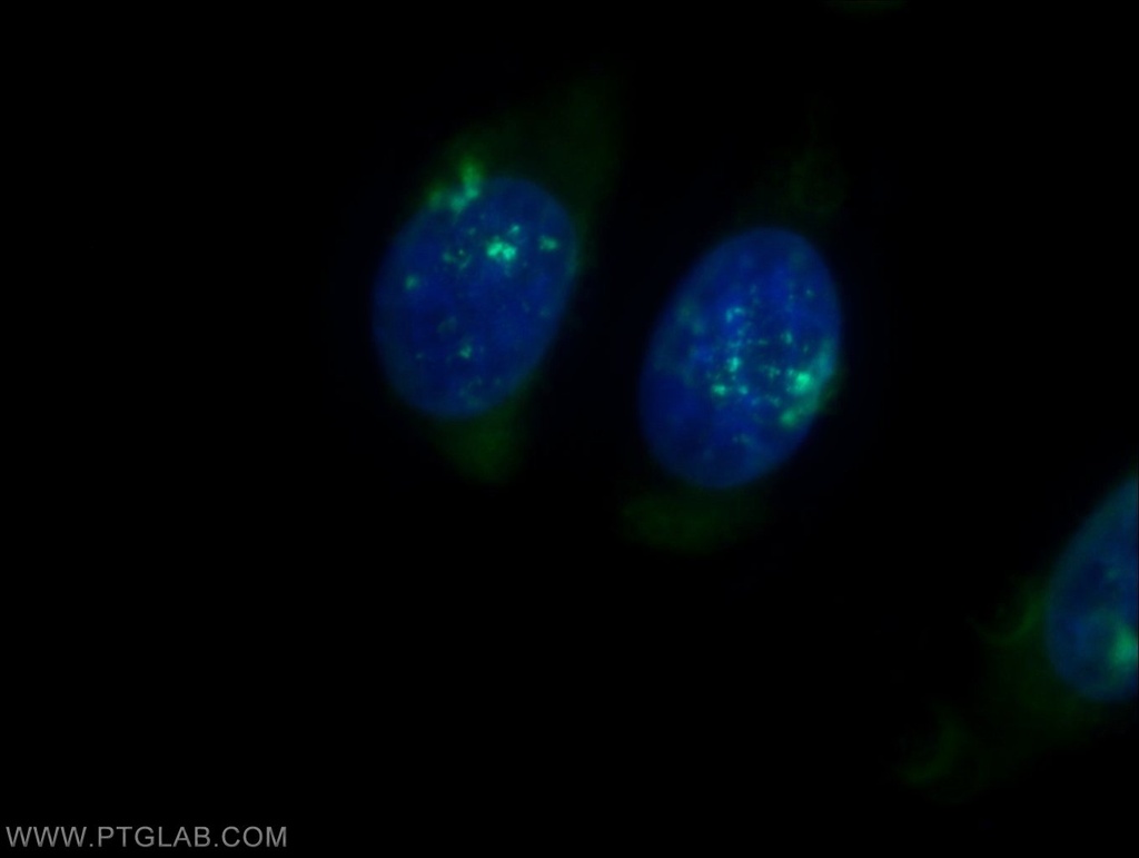 PSMB3 Polyclonal antibody