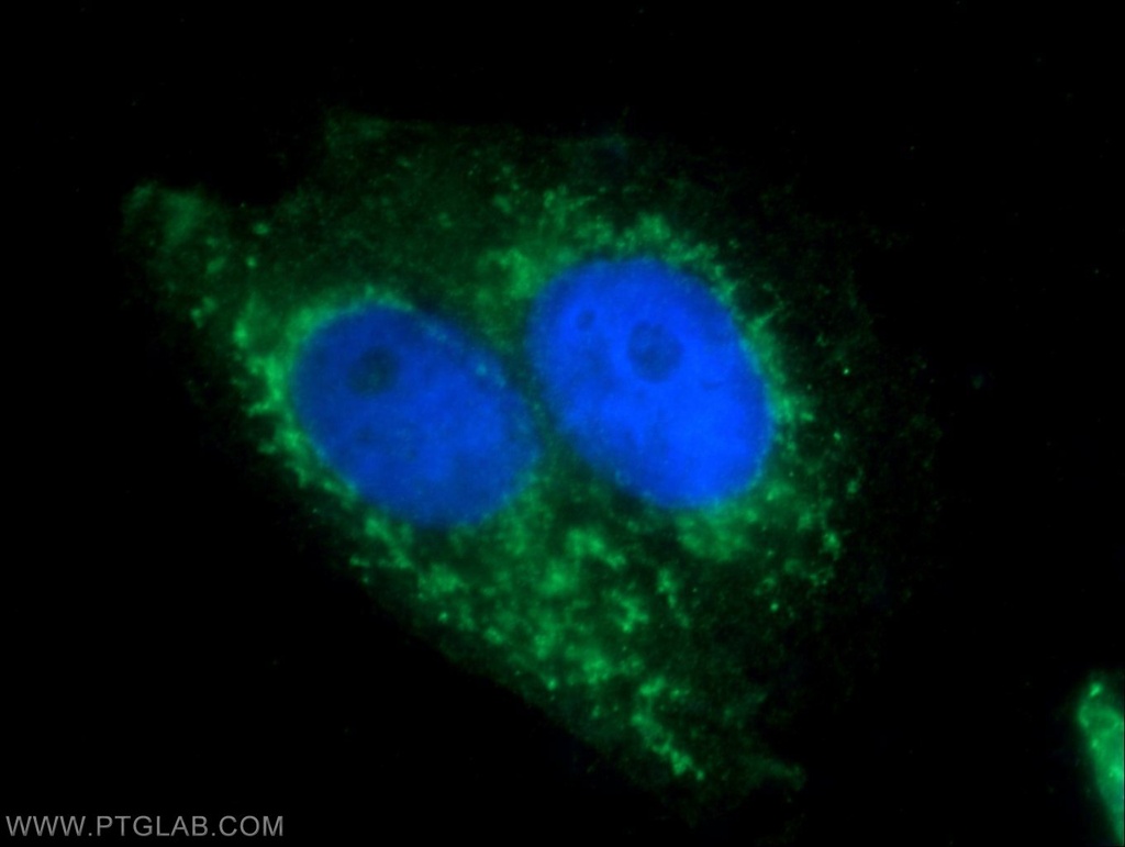 BAAT Polyclonal antibody