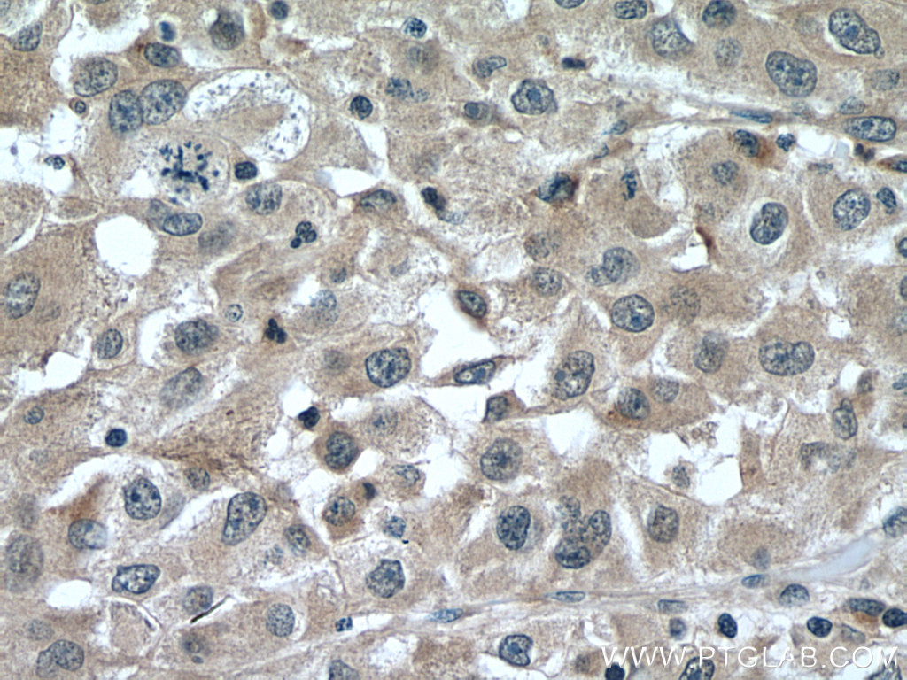 FGL1 Polyclonal antibody