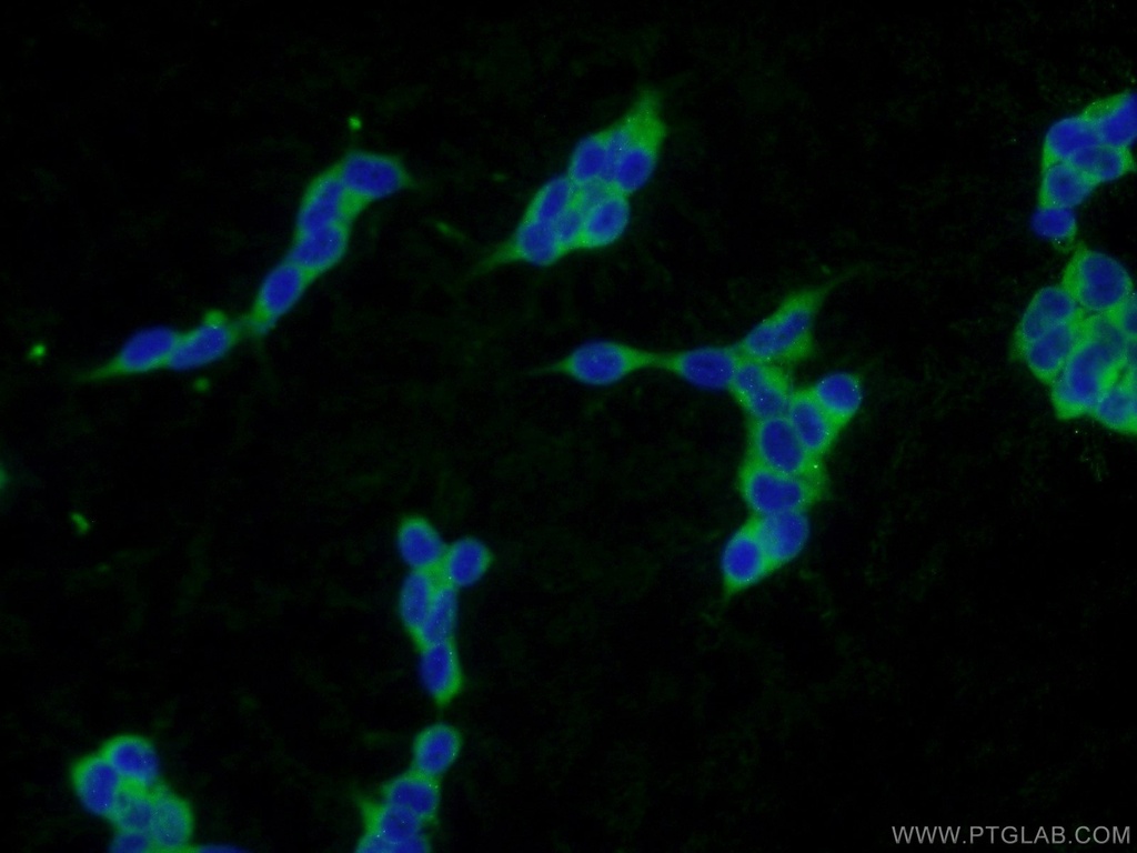 PLA2G12A Polyclonal antibody
