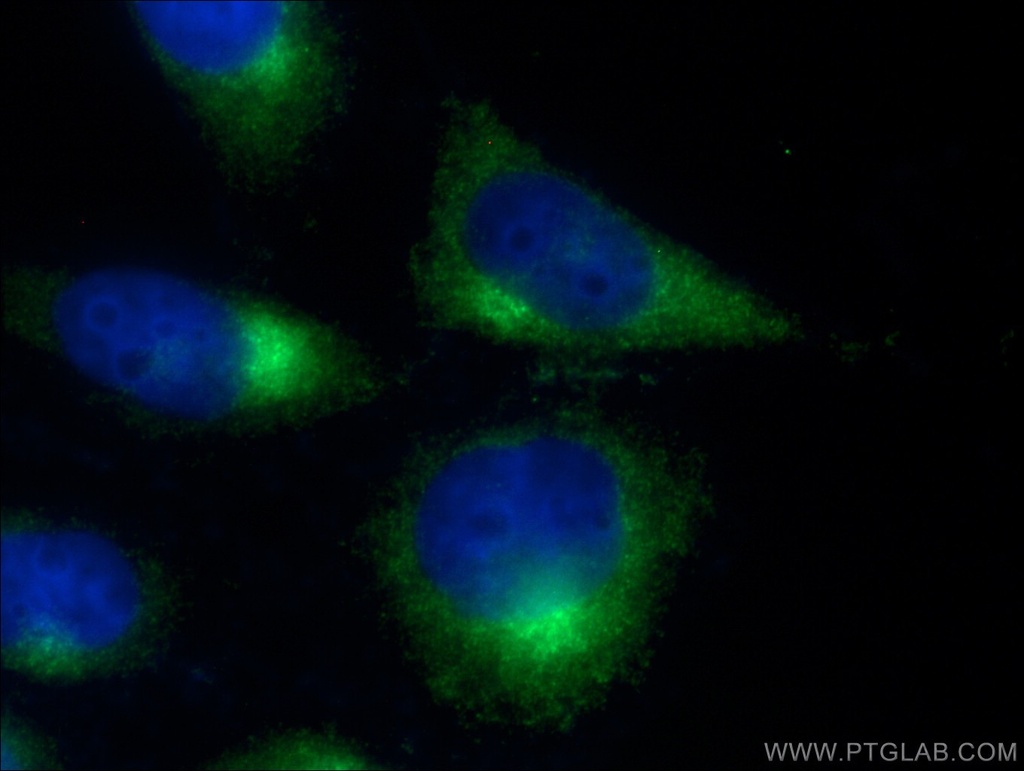 ARL1 Polyclonal antibody