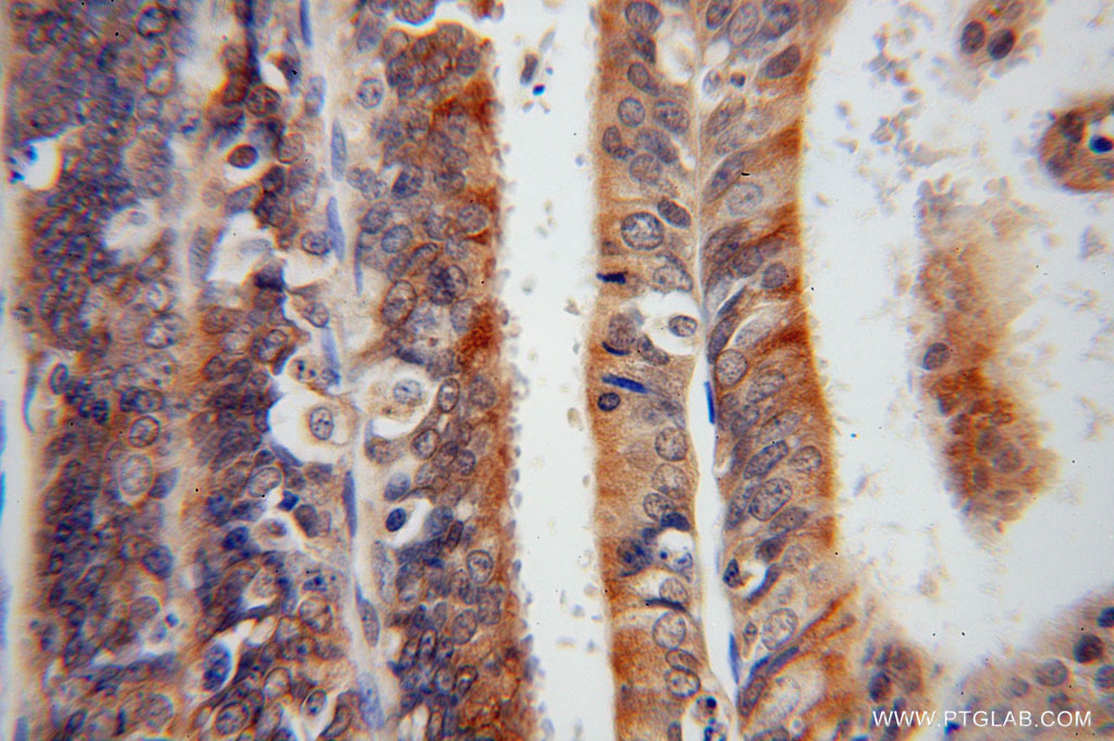 Syntaxin 18 Polyclonal antibody