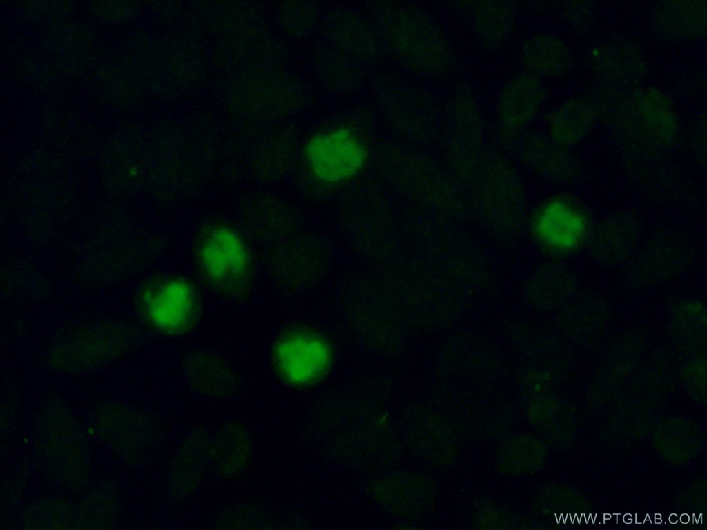 MMS19 Polyclonal antibody