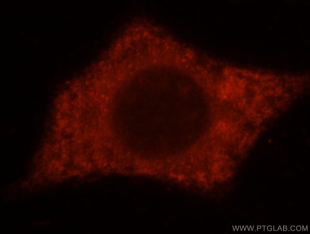 TXNDC4 Polyclonal antibody