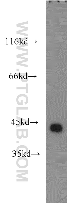 ILKAP Polyclonal antibody