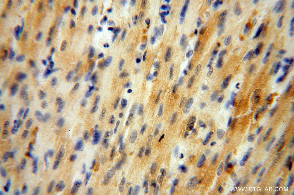 GALM Polyclonal antibody