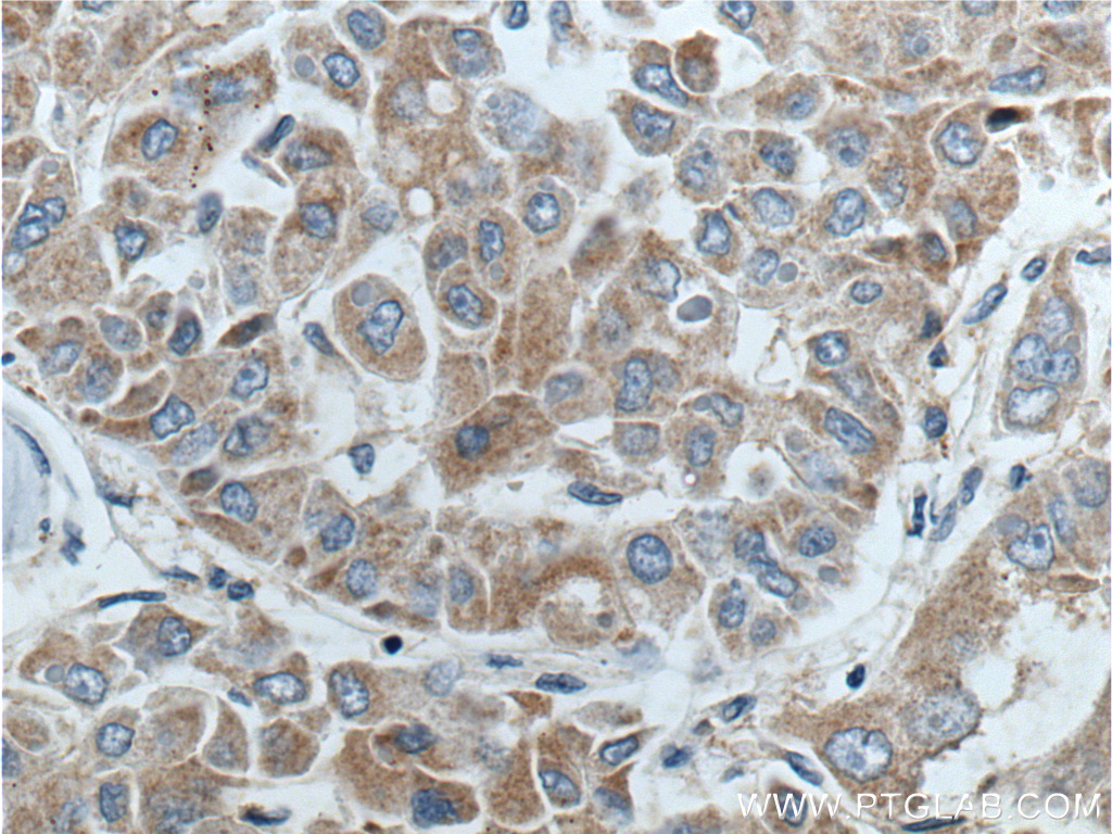 BCL2L2 Polyclonal antibody