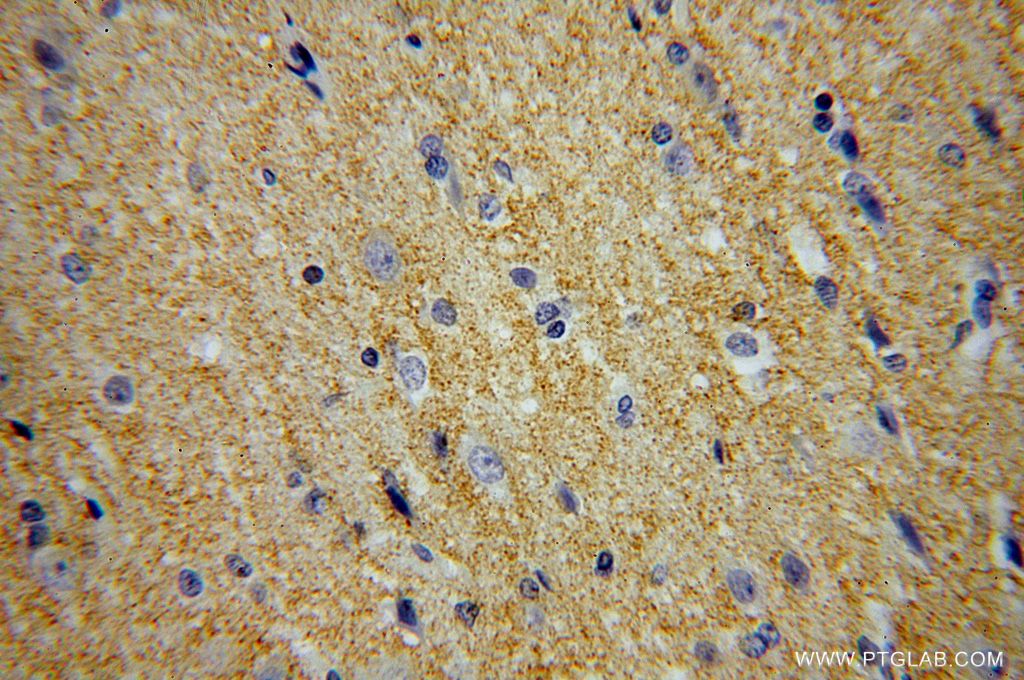 MANBAL Polyclonal antibody