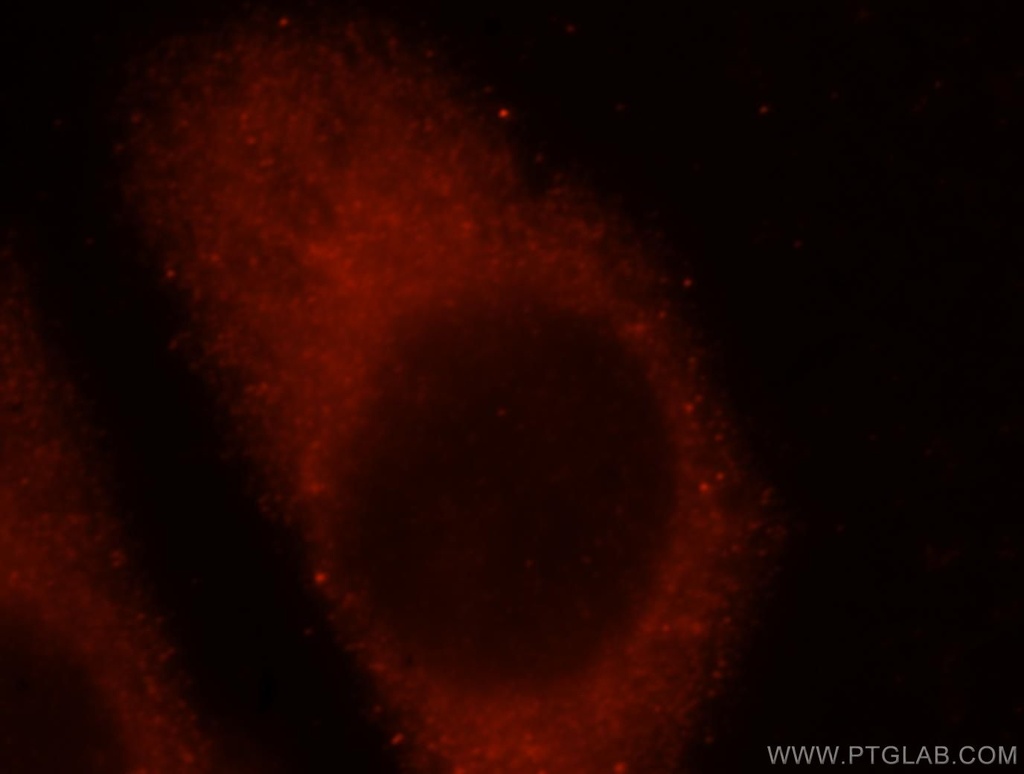 IFFO1 Polyclonal antibody
