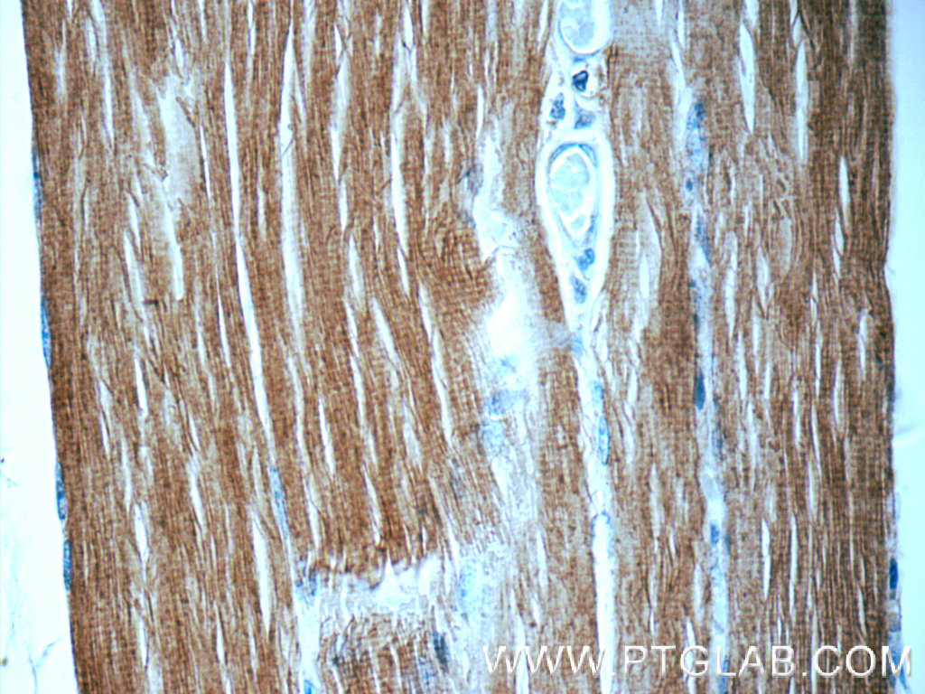 MYLPF Polyclonal antibody