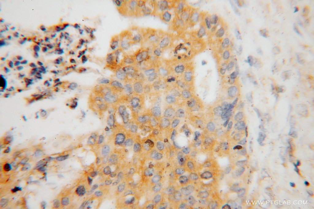 ATP6V1C1 Polyclonal antibody
