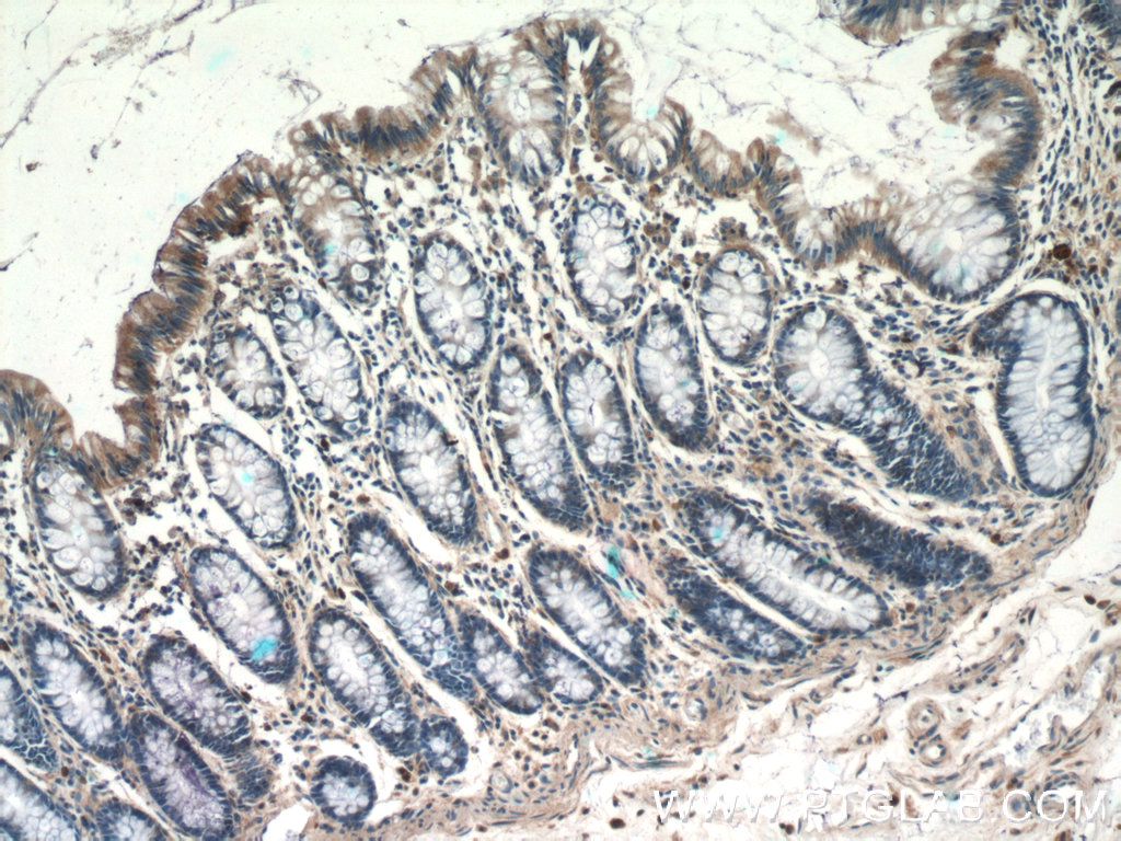 TSPAN1 Polyclonal antibody