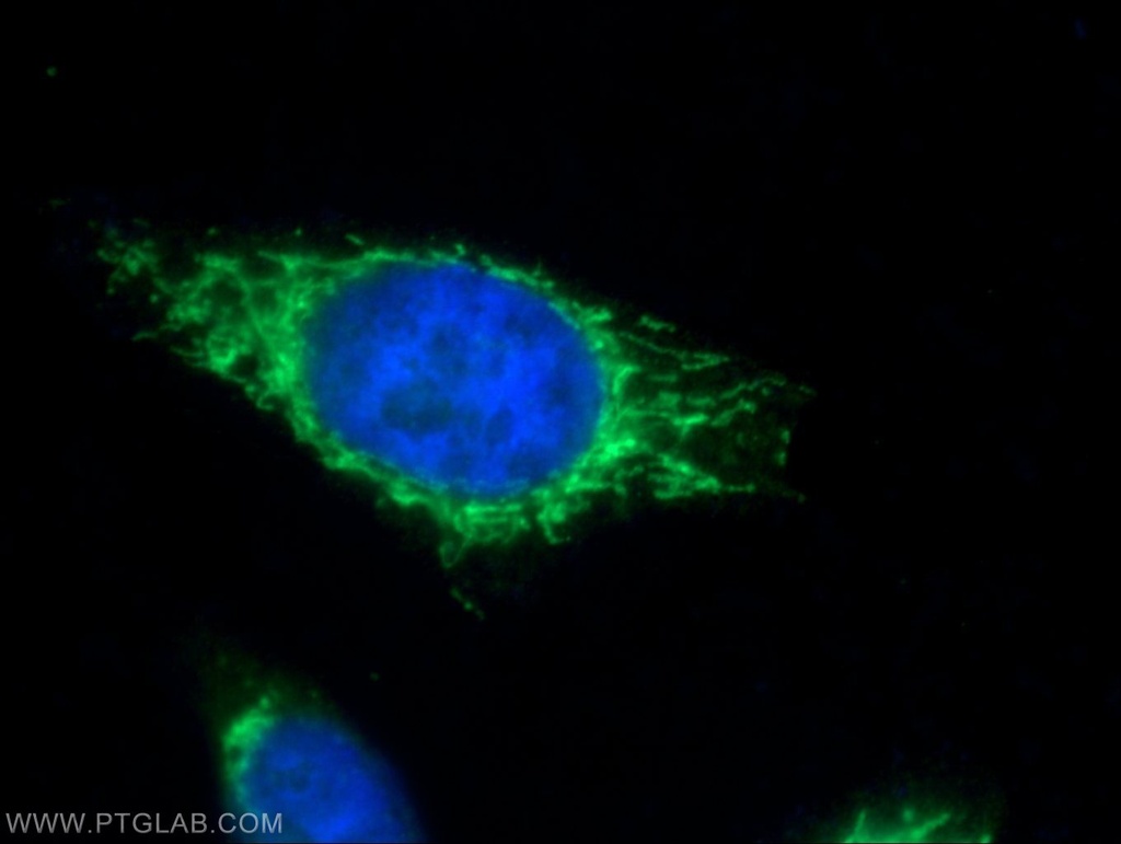 PMPCB Polyclonal antibody