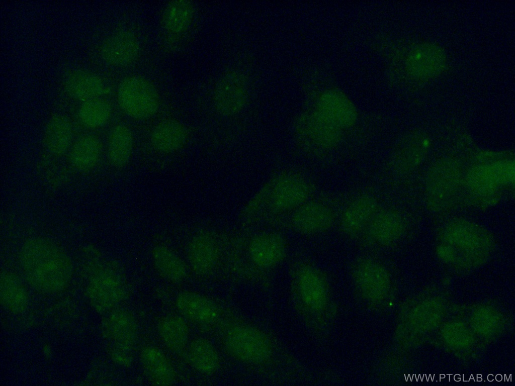 PIAS2 Polyclonal antibody