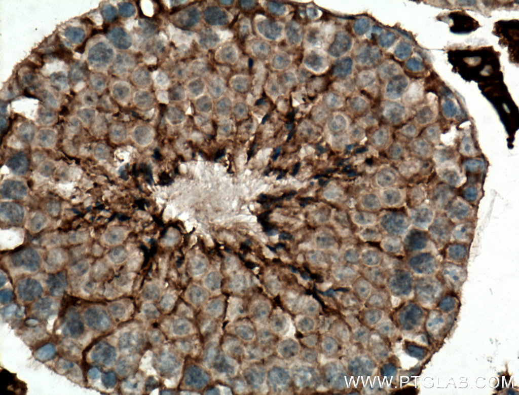 ACSBG1 Polyclonal antibody