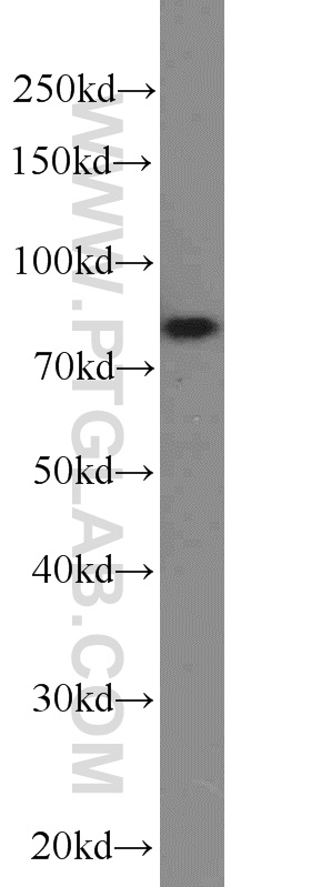 NOL9 Polyclonal antibody