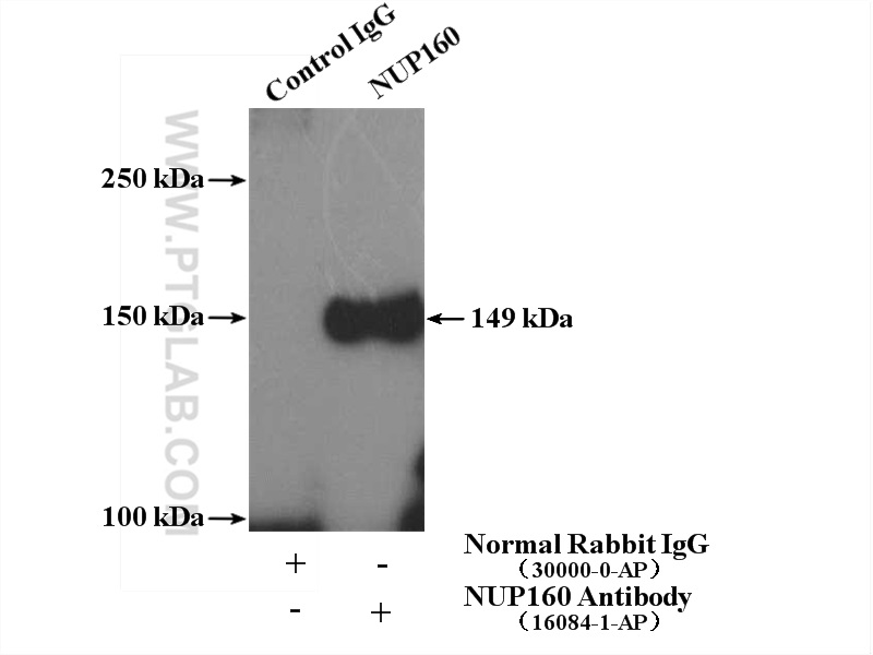 NUP160 Polyclonal antibody