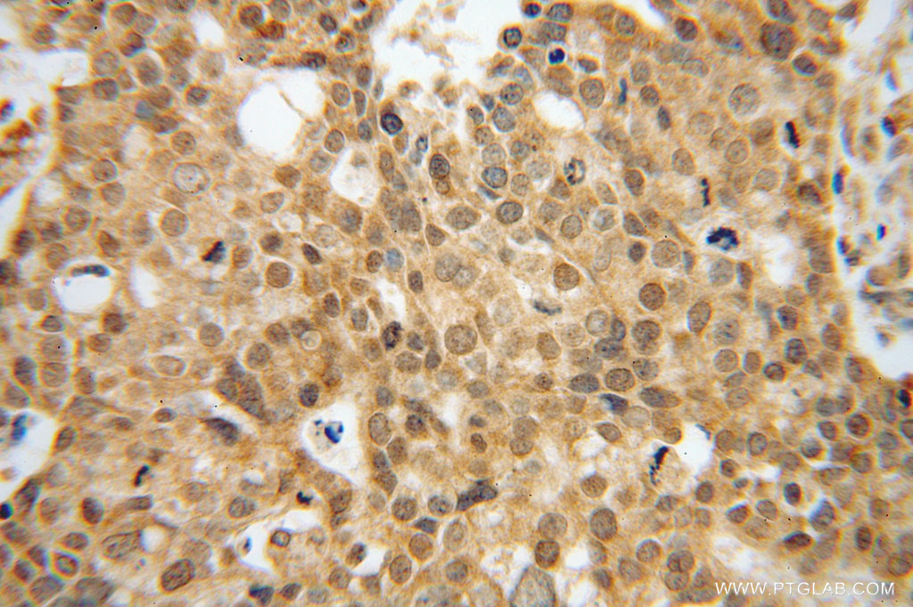 EEF1A2 Polyclonal antibody