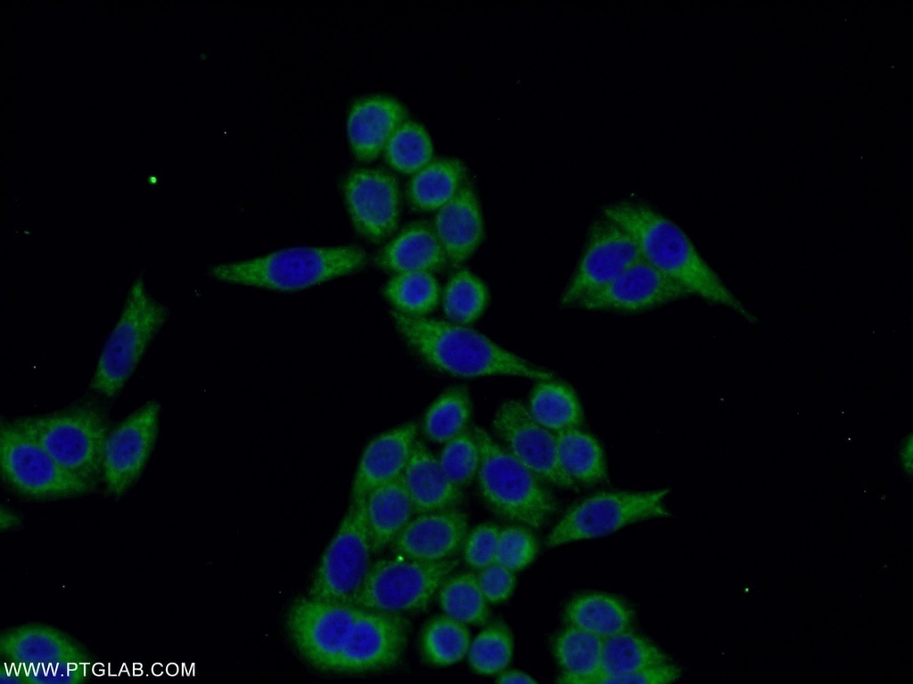 TMEM141 Polyclonal antibody