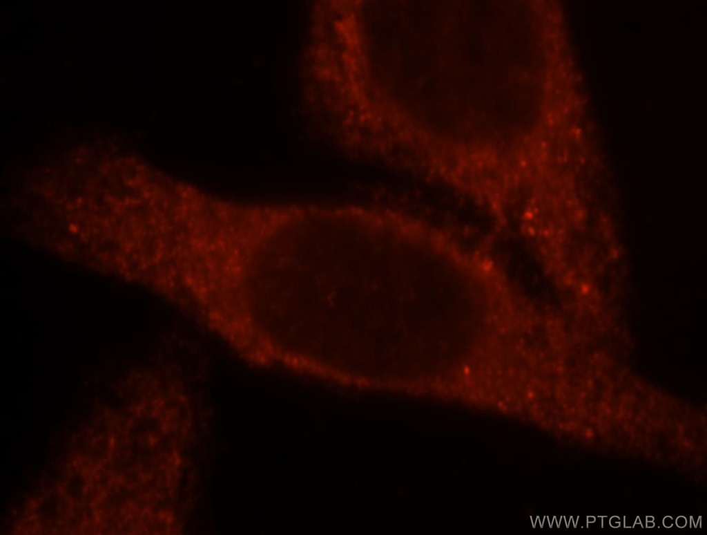 BBOX1 Polyclonal antibody