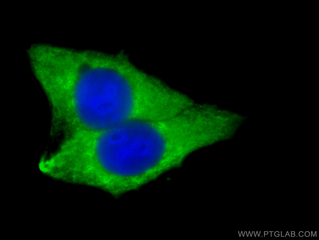 LPCAT1 Polyclonal antibody