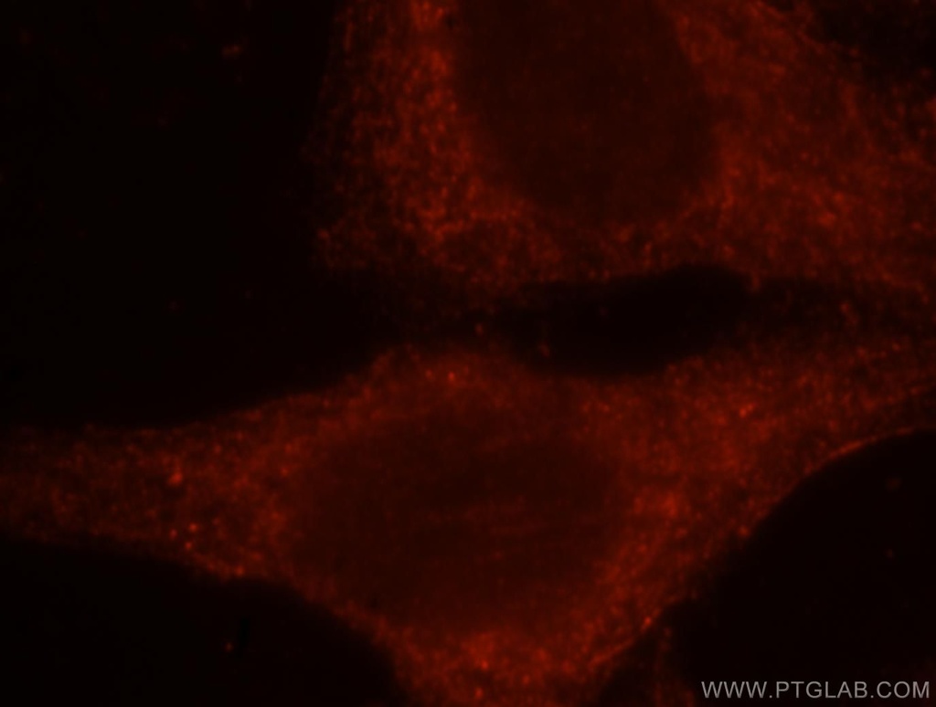 RAC1/2/3 Polyclonal antibody