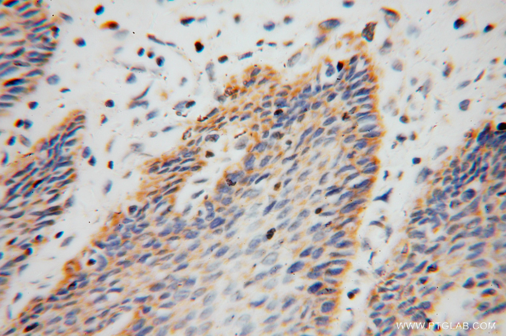 ARHGDIB Polyclonal antibody
