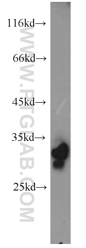 PHYHD1 Polyclonal antibody