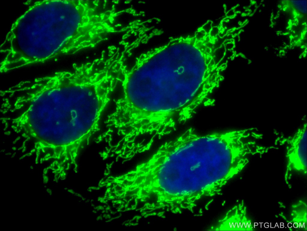 Citrate synthase Polyclonal antibody