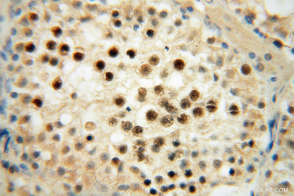 RNASEH2A Polyclonal antibody
