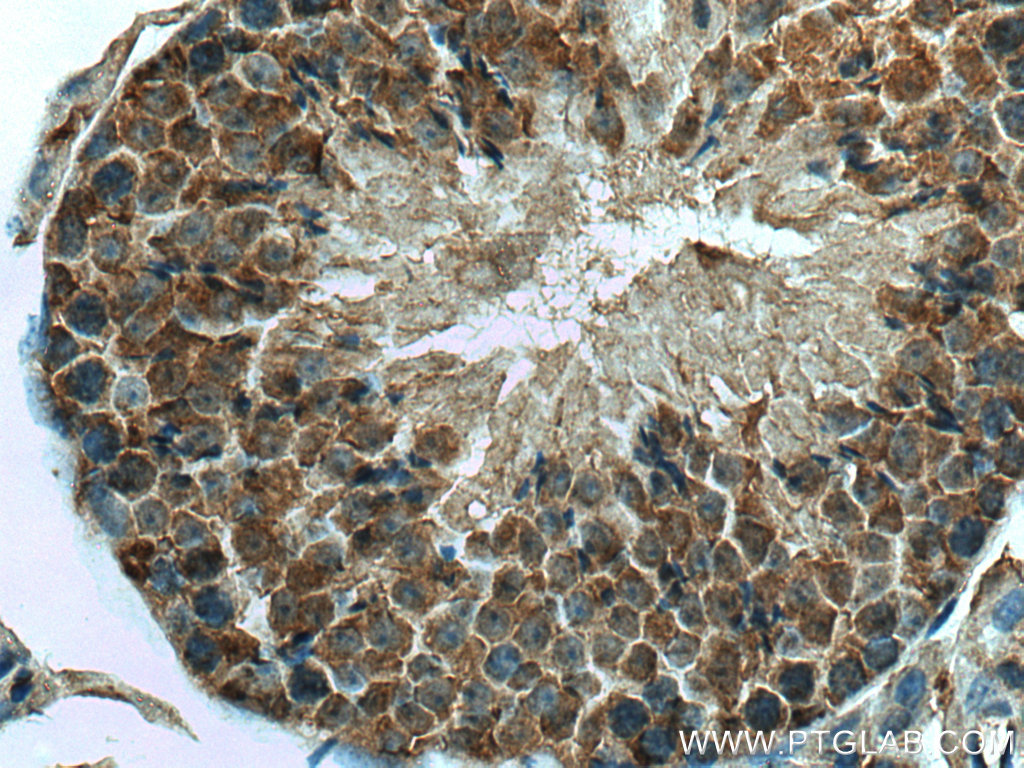 UBXN1 Polyclonal antibody