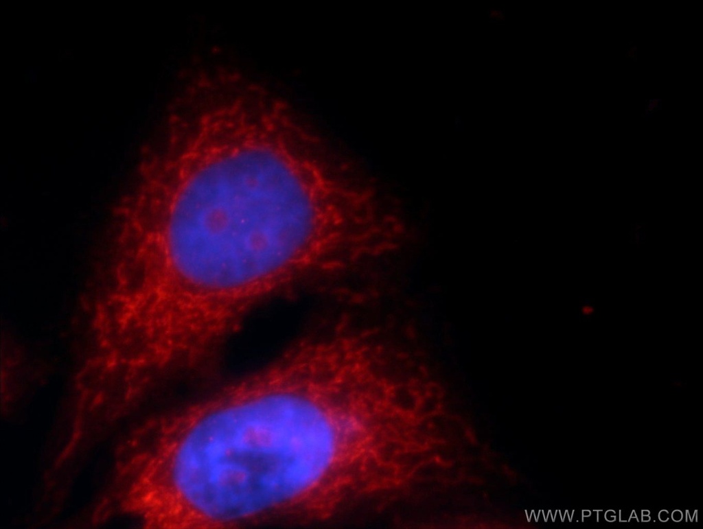 MRPS18B Polyclonal antibody