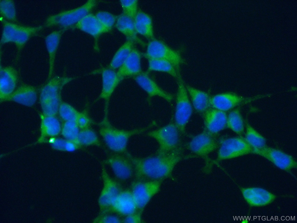 ATP6V1G1 Polyclonal antibody