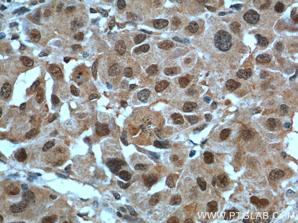 POLR1E Polyclonal antibody