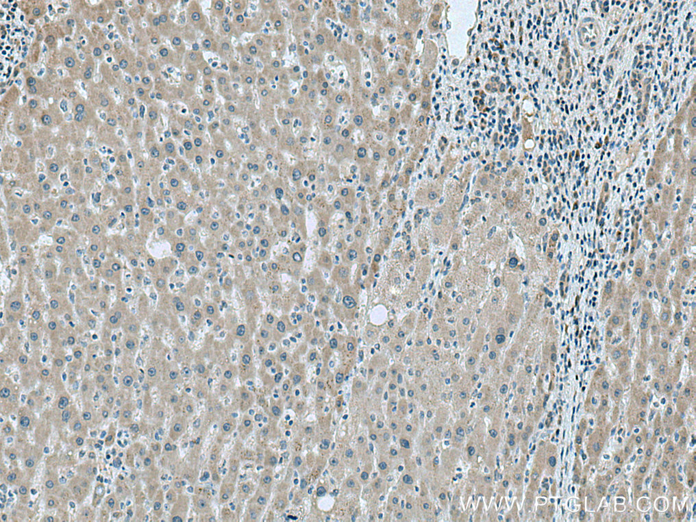 LYPLAL1 Polyclonal antibody