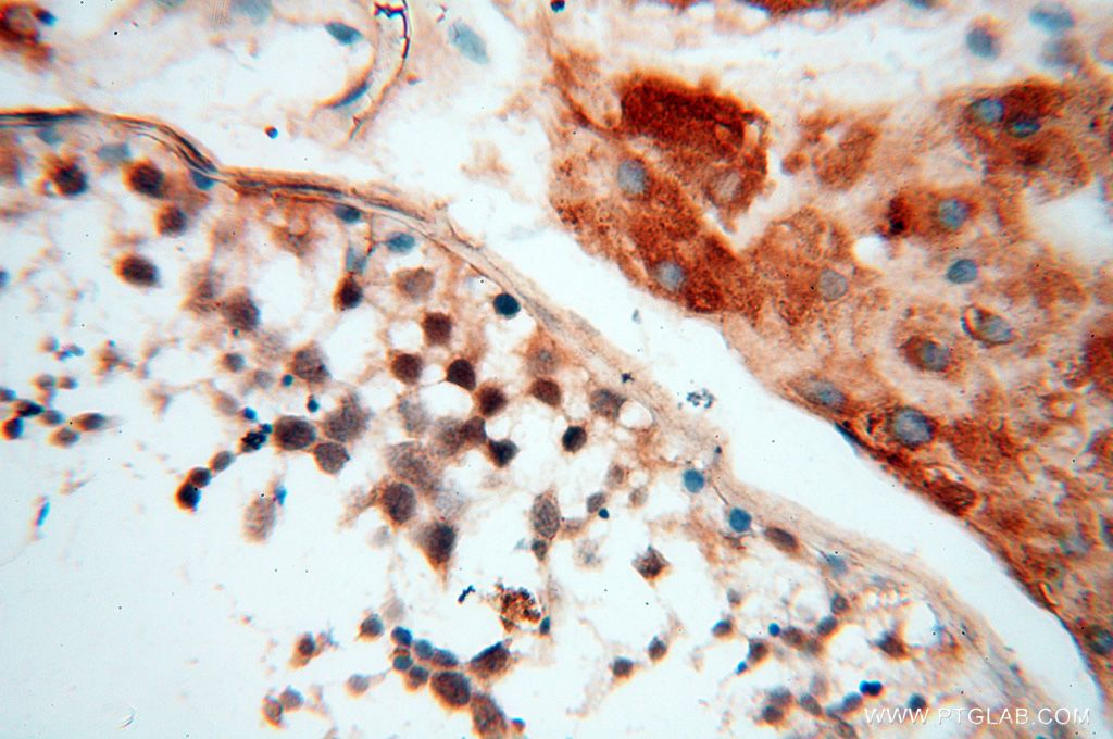 BAG1S/1M/1L Polyclonal antibody