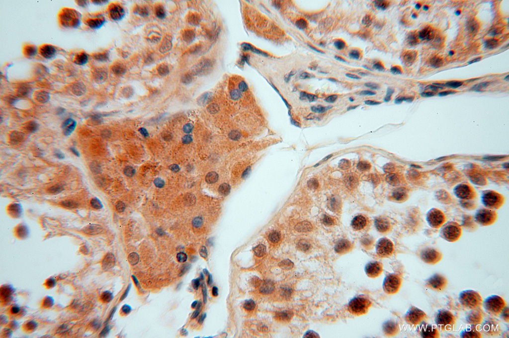 SMYD1-Specific Polyclonal antibody