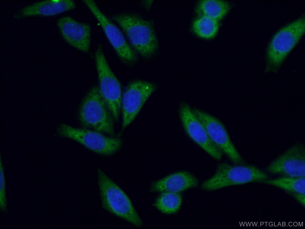 KRAS-2B-specific Polyclonal antibody