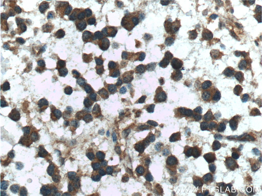 Presenilin-1-Specific Polyclonal antibody