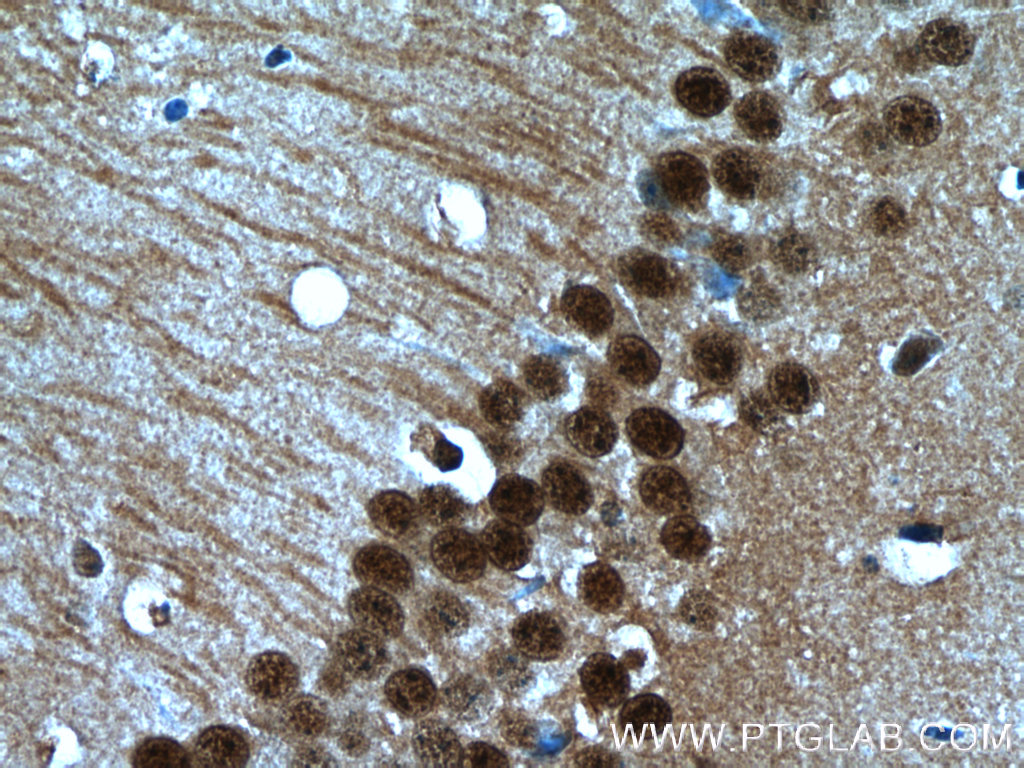 HDAC6-specific Polyclonal antibody