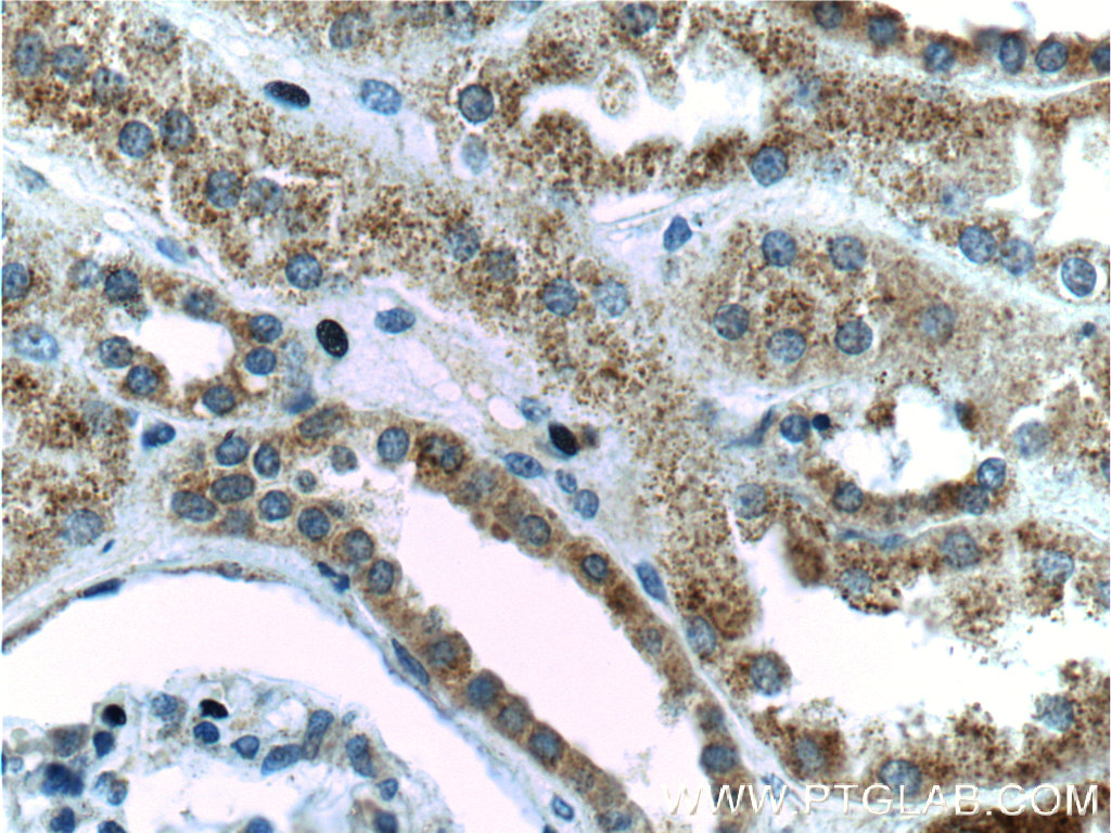 PSEN2-Specific Polyclonal antibody