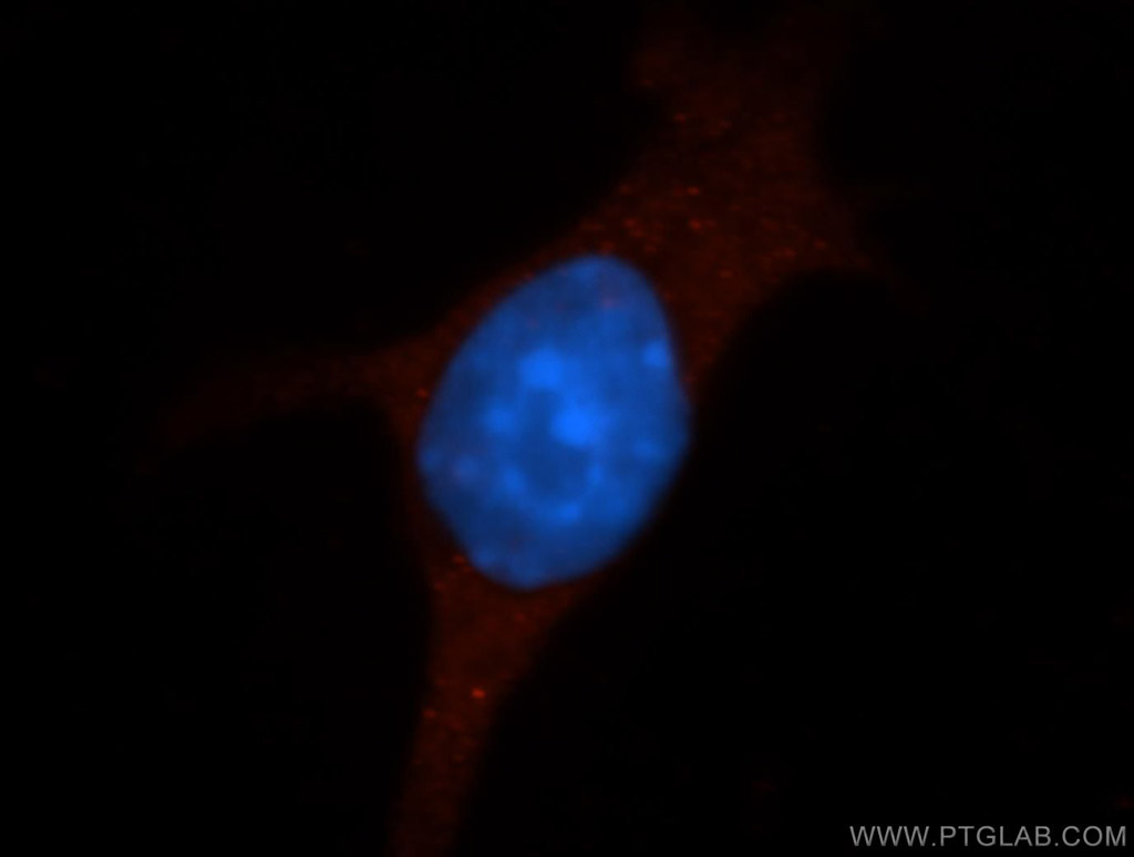 Icam-1 Polyclonal antibody