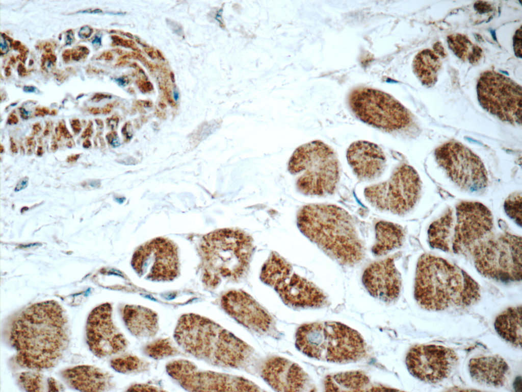 RAB31-specific Polyclonal antibody