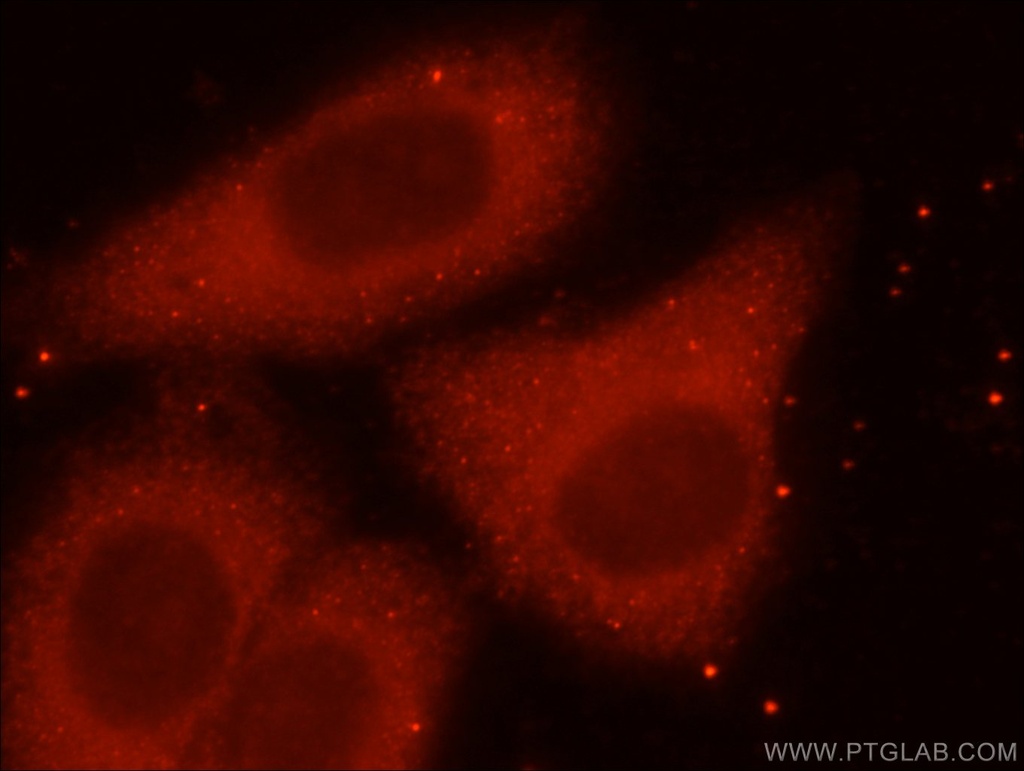 ING4-specific Polyclonal antibody