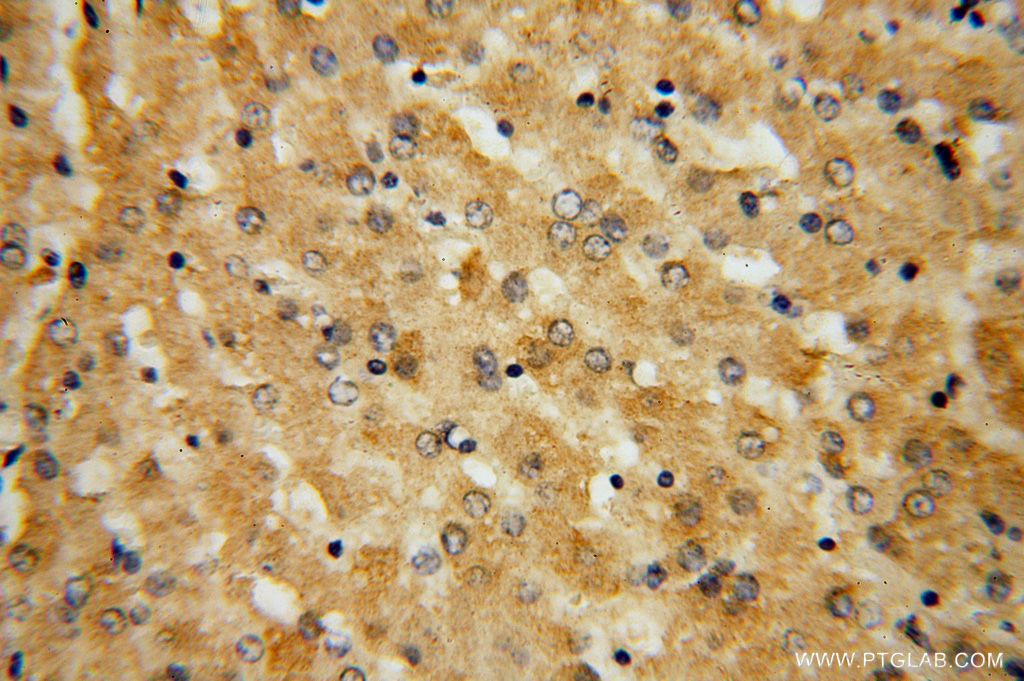 GGCX Polyclonal antibody