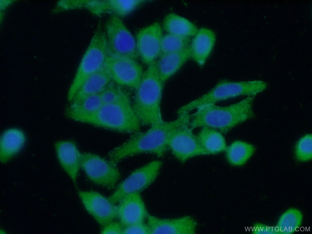 ASS1 Polyclonal antibody